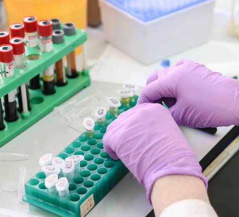 Una persona está manipulando tubos de ensayo en un laboratorio.
