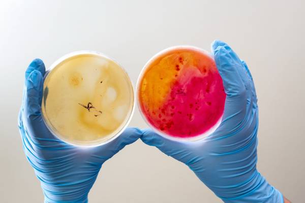 Una persona sostiene dos placas de Petri con cultivos microbiológicos de diferentes colores.