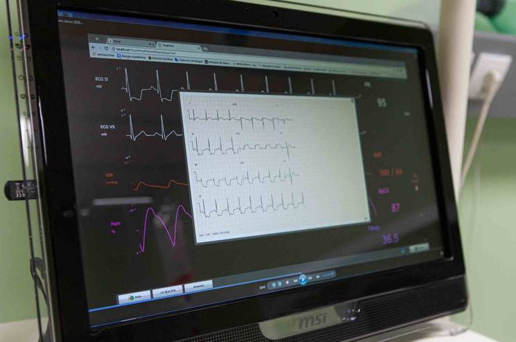 electrocardiograma