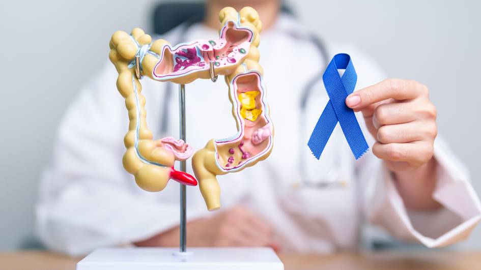 Un médico sostiene un modelo anatómico del sistema digestivo mientras muestra un lazo azul.