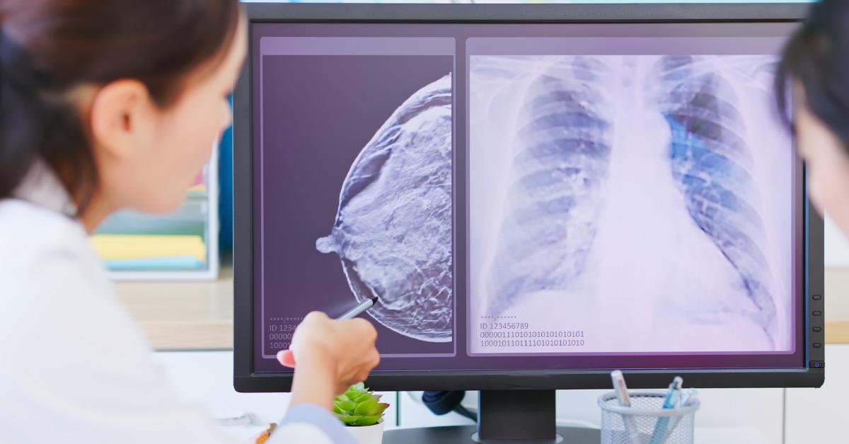 Una profesional de la salud revisa radiografías en un monitor.